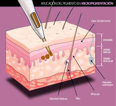 micropigmentación en la epidermis