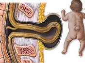 Prevención espina bífida embarazo