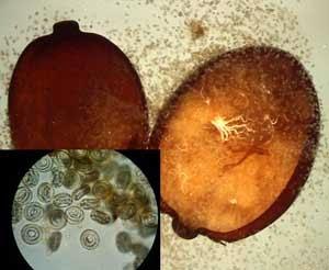 Mind Altering Organisms: Hormigas con culo de Baya