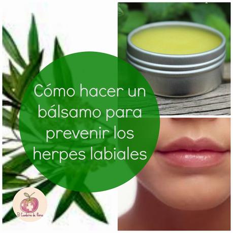 Cómo hacer un bálsamo para prevenir los herpes labiales