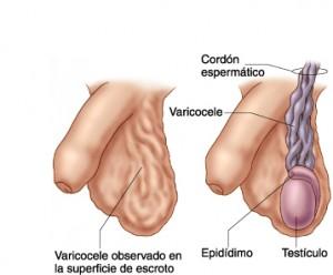 Problemas Comunes del Pene