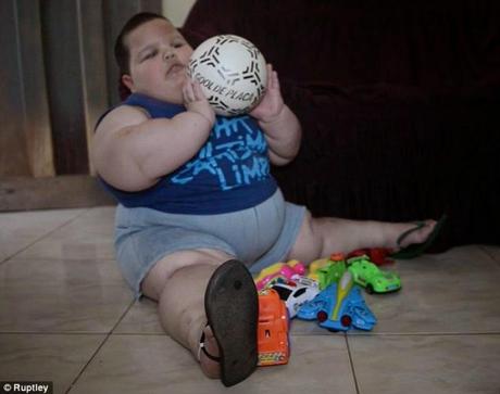 Niño brasileño de 3 años pesa 70 kg