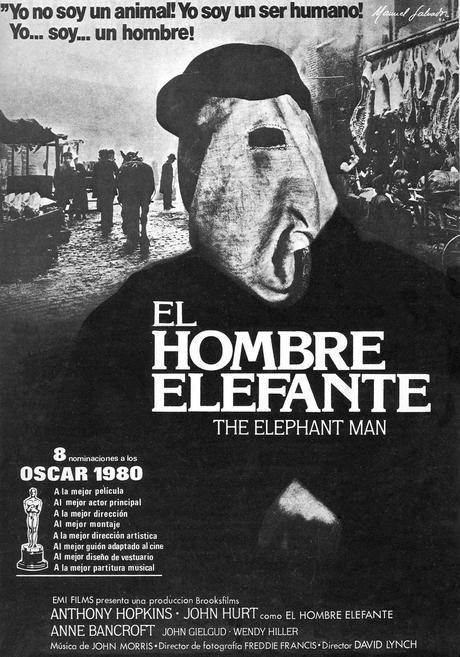 El hombre elefante existe