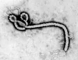 New York Times: Algunos pueden llevar el Ebola sin mostrar ningún sintoma