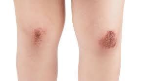 farmaceuticainmavinue