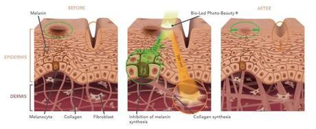 Descubre con Talika los beneficios que puede aportar la luz natural a tu piel accion antiedad talika