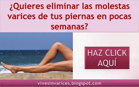 como eliminar las varices en las piernas