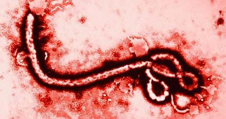 El ébola, cómo se transmite y por qué es tan peligroso