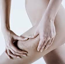 eliminar celulitis