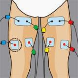 COMPEX, RECUPERACIÓN DE ISQUIOTIBIALES
