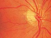 Detección precoz retinopatía diabética 2014