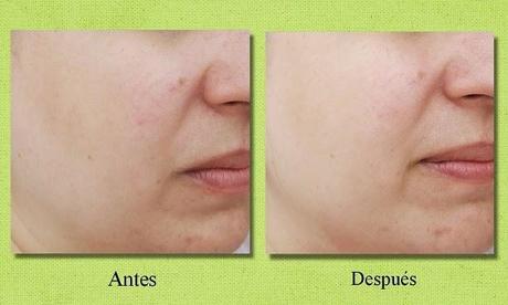 La mascarilla con vitamina C “Pure Vita C Dual Mask” de ROJUKISS (From Asia With Love)