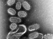Enfermedades bacterianas viricas