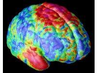 10 Datos curiosos sobre el cerebro