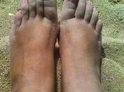 Premio ganado ddermacorporal: aceite rosa mosqueta