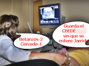 ecocardiogramas pueden salvar vidas, fútbol gallego pionero