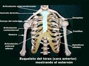 Condritis esternocostal