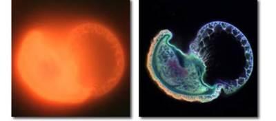 Comparación entre una microfotografía de fluorescencia tomada con un microscopio óptico vs microscopio confocal de una grano de polen.  Tomado de olympusconfocal.com.