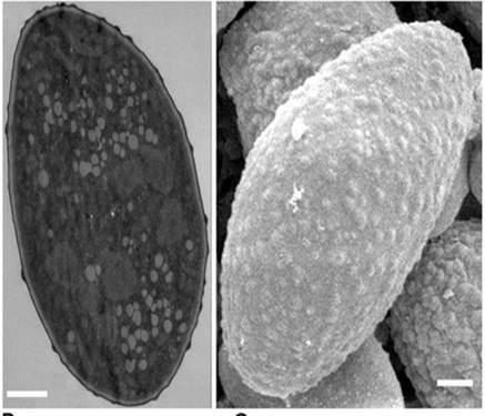 Microfotografías de granos de polen tomadas con TEM (izquierda) y SEM (derecha). La barra blanca representa 1 micrómetro. Tomada de  http://www.plospathogens.org/article/info%3Adoi%2F10.1371%2Fjournal.ppat.1002086 