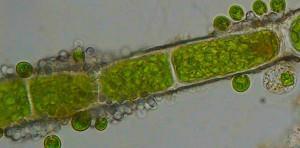 Fotografía de alga verde tomada con microscopio óptico 400x, es decir, aumentada 400 veces *. 