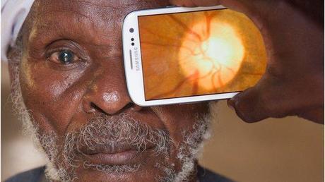 ¿El futuro de la salud ocular?