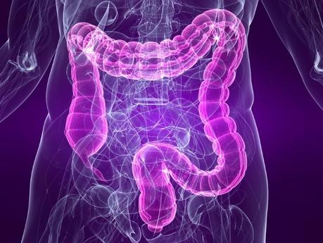 Cómo tratar el síndrome del intestino irritable o colon irritable