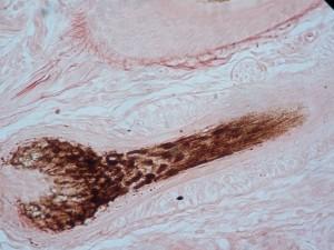 1280px-Hair_follicle_long_400_02