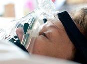 Esclerosis lateral amiotrófica: síntomas tratamiento