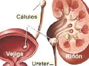 Historia amiga cálculos recurrentes cistinuria