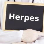 Remedios caseros para el Herpes Genital