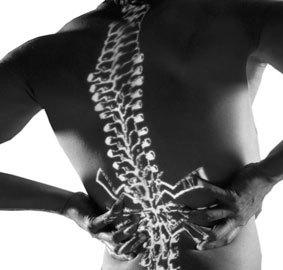 artricenter espalda