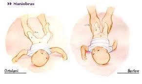 Lo que no sabiamos de la displasia de caderas