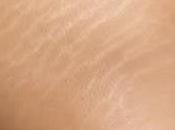 Palabra farmacéutica: ESTRÍAS ACEITE MASAJE PARA WELEDA