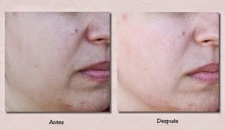 Las mascarillas faciales de FREEMAN