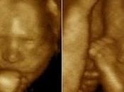 Descubren cómo gemelos tocan acarician vientre madre