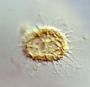 Skiagia ornata, del Cámbrico Inferior. Imagen del Museo de Geología de la Universidad de Tartu.