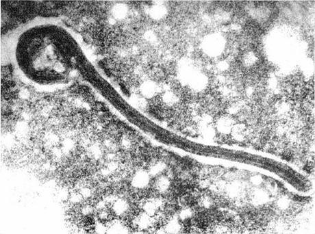 El virus del Ébola y el de Marburgo “editan” material genético durante la infección.