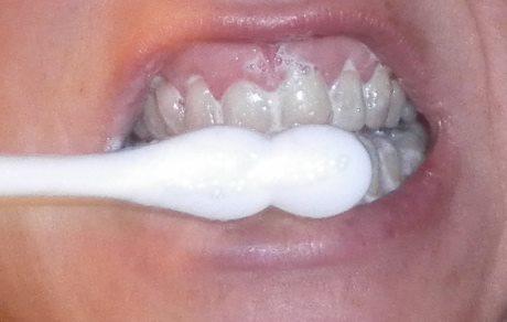 Enjuague bucal fluorado, enjuague bucal, enjuague, colutorio, fluor, crema dental, pasta de dientes, blanqueadora, dentrífico, elixir, cepillo dientes, salud, higiene, salud bucal, buco-dental