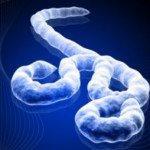 Virus Ébola, todo lo que necesita saber