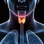Tratamientos alternativos para el cáncer de tiroides