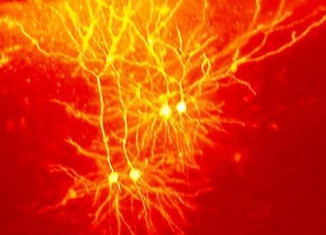 Hongos alucinógenos crean hiperconexiones cerebrales