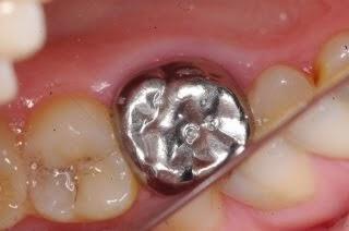 DE VAMPIROS, DIENTES Y OTROS DESVARÍOS .#DIARIODEMADRELOCA DE VAMPIROS, DIENTES Y OTROS DESVARÍOS .#DIARIODEMADRELOCA