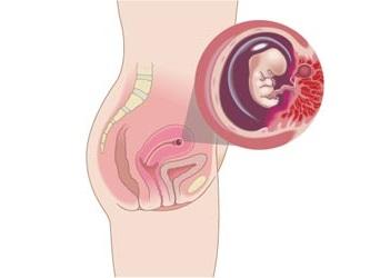 embrion en semana 8 de embarazo