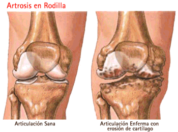 ¿Puede la web social ayudar al paciente crónico osteomuscular?