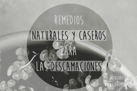 Remedios naturales y caseros para las descamaciones