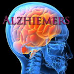 Las mejores apps para cuidadores de enfermos de alzheimer alzheimers