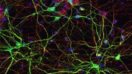 Neuronas espinosas medianas