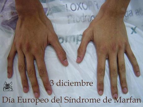 El 3 de diciembre es el día europeo del síndrome de Marfan