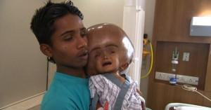 Nace niño en la India con dos cerebros en el mismo cuerpo The boy's father