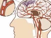 asociado ictus jóvenes